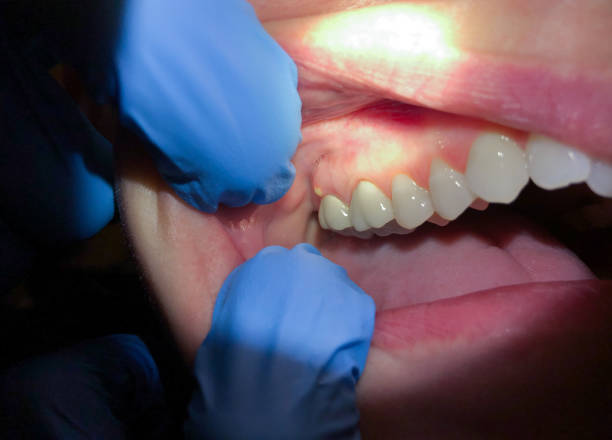 Best Mobile Emergency Dentist in Nitro, WV