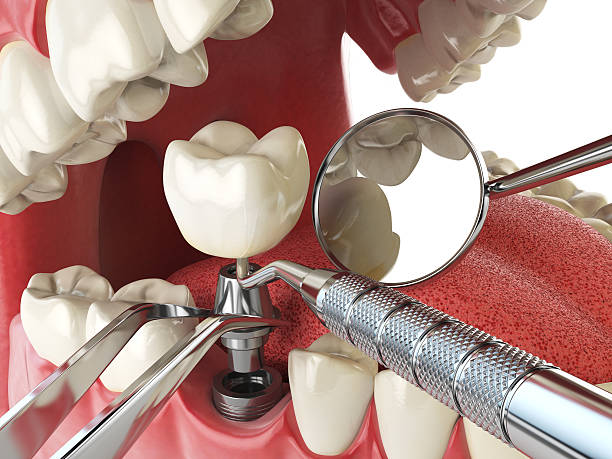 Best Emergency Dental Extractions in Nitro, WV